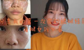 激光治疗雀斑的价格